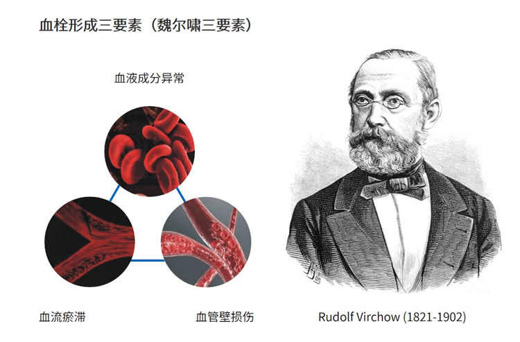 世界血栓日 | 拴不住，動起來