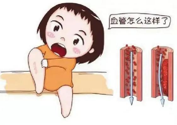 腫瘤不容忽視的第二號(hào)殺手—VTE，該如何防治？