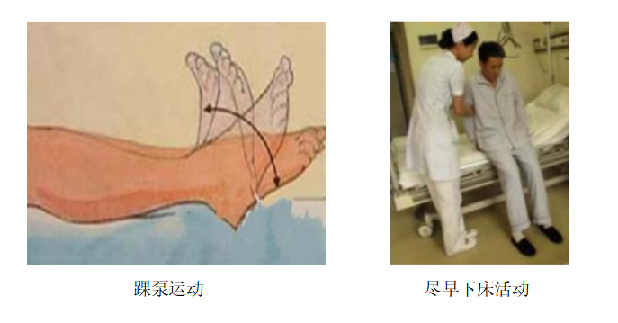 圍術(shù)期患者VTE的預防，只知道抗凝可不行