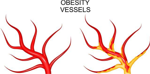 老年人如何預防下肢靜脈血栓 哪些癥狀提示下肢靜脈有血栓了 老年人如何預防下肢靜脈血栓 哪些癥狀提示下肢靜脈有血栓了