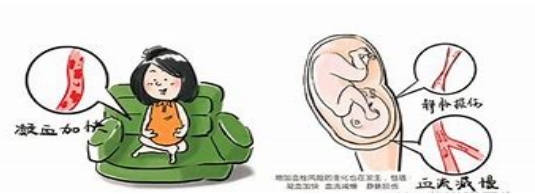 妊娠過程中的“潛伏殺手”——易栓癥 妊娠過程中的“潛伏殺手”——易栓癥